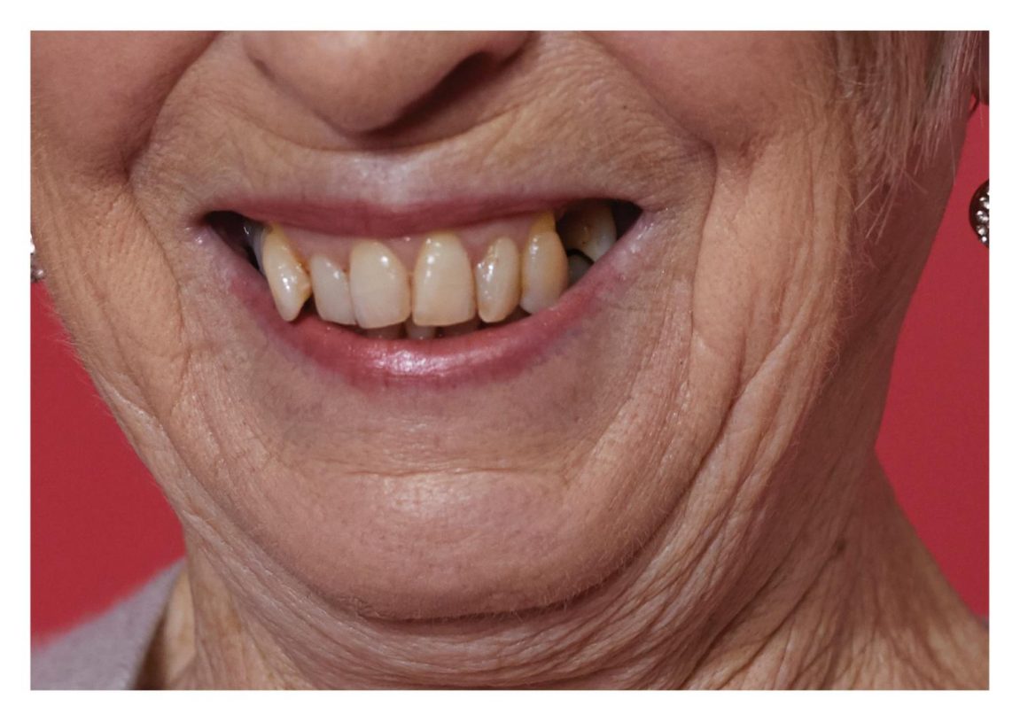 Alice Rosati, <i>Dismorphia #</i>1, 2018, Hahnemühle Photo Rag® Bright White