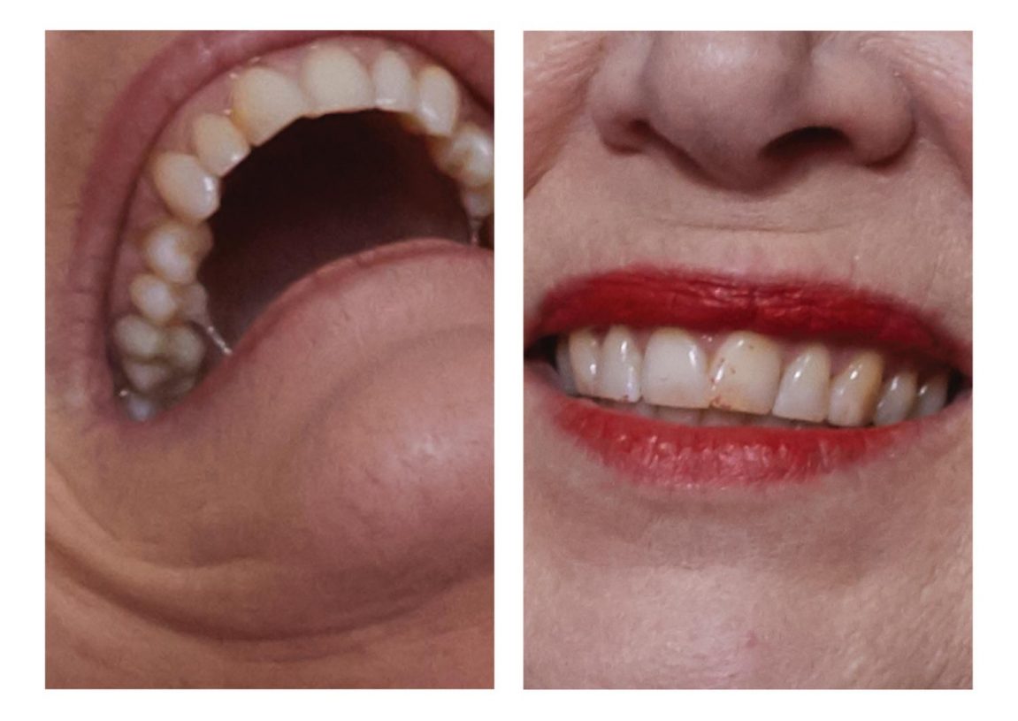 Alice Rosati, <i>Dismorphia #2</i>, 2018, Hahnemühle Photo Rag® Bright White